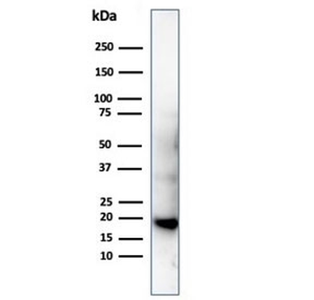 His Tag Antibody / Histidine