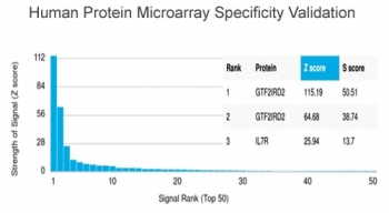 GTF2IRD2 Antibody / GTF2IRD2 alpha
