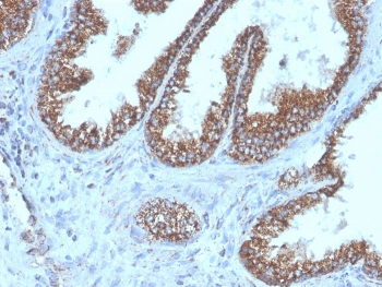 TMEPAI Antibody / PMEPA1