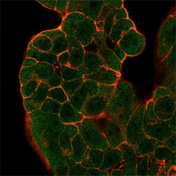 GTF2H2 Antibody / BTF2 p44 / TFIIH