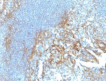 ICAM1 Antibody / CD54