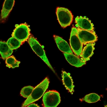EIF2A Antibody / EIF2S1
