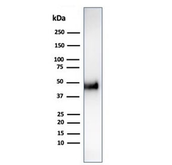 Cyclin E1 Antibody / CCNE1