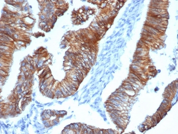 p120 Catenin Antibody / CTNND1 / Catenin delta 1