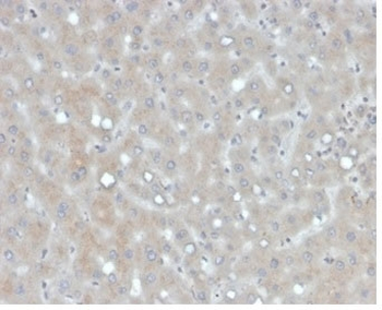 APOB Antibody / Apolipoprotein B