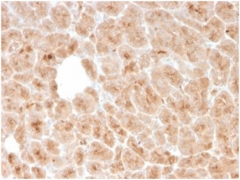 LMO2 Antibody / Rhombotin 2
