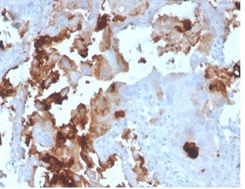 BPIFB1 Antibody / LPLUNC1