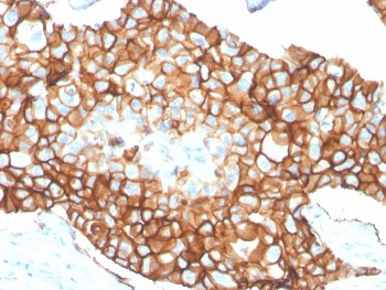 HER2 Antibody / ErbB2 / Extracellular region