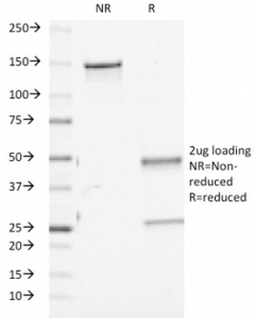 TGF Beta 1/2/3 Antibody / TGFB1/2/3