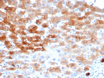 KRT8 Antibody / Cytokeratin 8