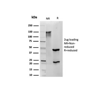 S100B Antibody