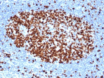 Ki-67 Antibody