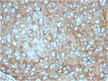 RPSA Antibody / 40S Ribosomal protein SA