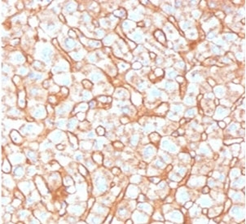 APOB Antibody / Apolipoprotein B