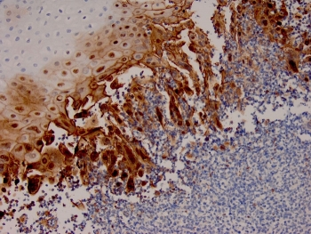 HSV1 Antibody / Herpes Simplex Virus Type I