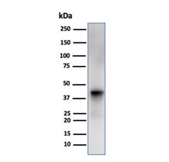 Glutamine Synthetase Antibody / GLUL
