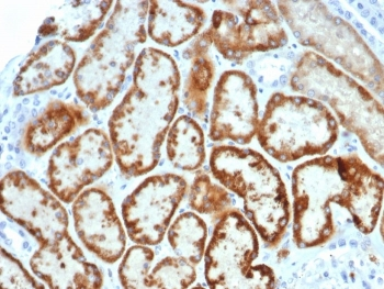 AMH Antibody / Anti-Muellerian Hormone