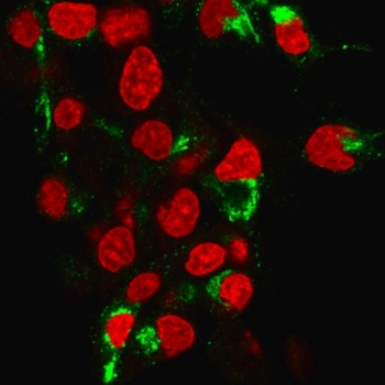 Albumin Antibody / ALB