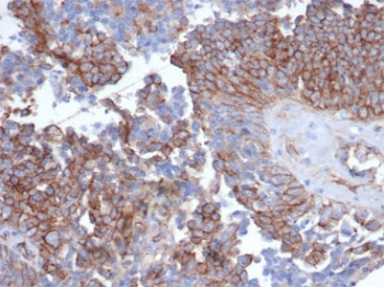 N-Cadherin Antibody / CDH2