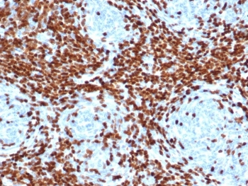 TdT Antibody / DNA nucleotidylexotransferase