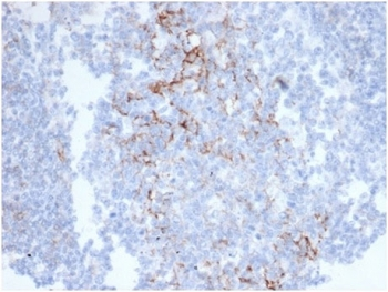 CD23 Antibody