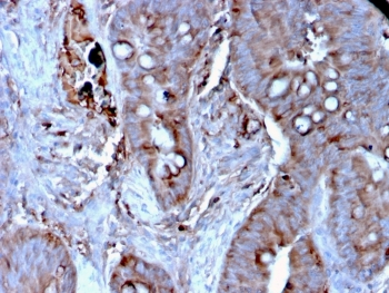 MerTK Antibody