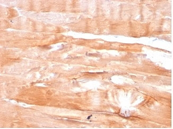 Dystrophin Antibody / DMD