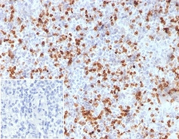 Resistin Antibody / RETN