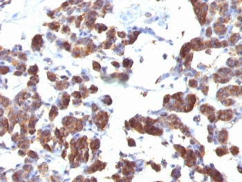 TG Antibody Cocktail / Thyroglobulin