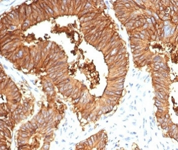 EpCAM Antibody / Cytoplasmic domain