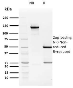 HPV16 E2 Antibody