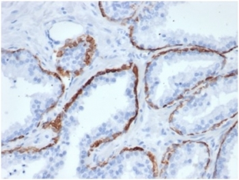 Cytokeratin 5 Antibody / KRT5