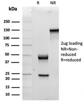 IL15 Antibody