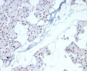 PHOX2B Antibody