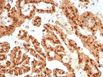 STAT6 Antibody
