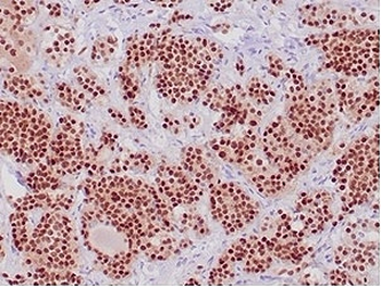 POU1F1 Antibody / PIT-1 / GHF-1