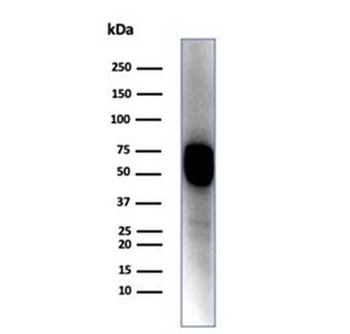 Cytokeratin 14 Antibody / CK14 / KRT14