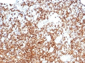 CD13 Antibody / ANPEP