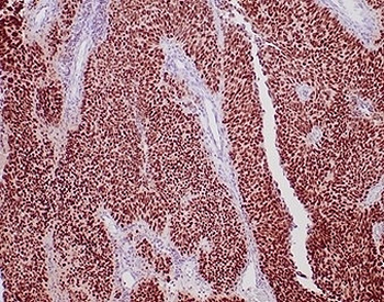 GATA3 Antibody