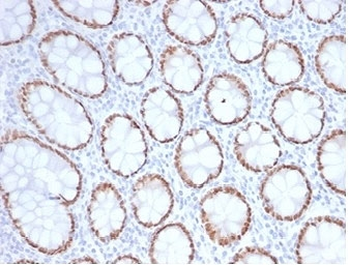 SATB2 Antibody