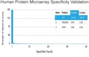 Clusterin Antibody / Apolipoprotein J / APO-J