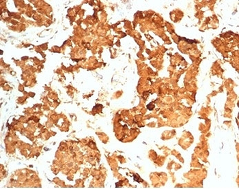 HCG-beta Antibody