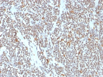 ATRX Antibody / RAD54