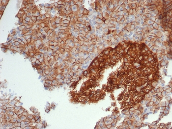 CD99 Antibody / MIC2