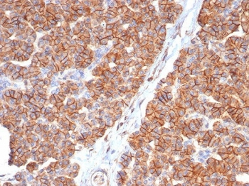 CD99 Antibody / MIC2
