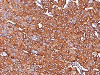 Synaptophysin Antibody