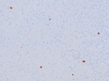 HSV1 Antibody / Herpes Simplex Virus Type I