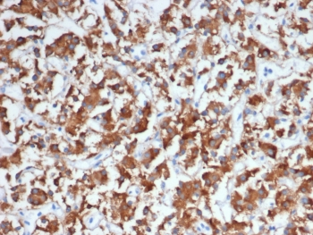 DBH Antibody / Dopamine beta Hydroxylase