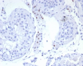 Steroidogenic Factor 1 Antibody / SF-1 / NR5A1