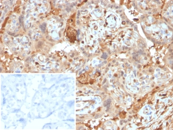 Alpha 1 microglobulin Antibody / AMBP / Bikunin